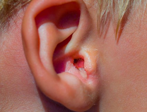 What is Swimmer’s Ear?